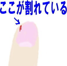 指.jpg