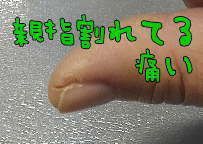 親指.jpg